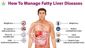 fatty liver